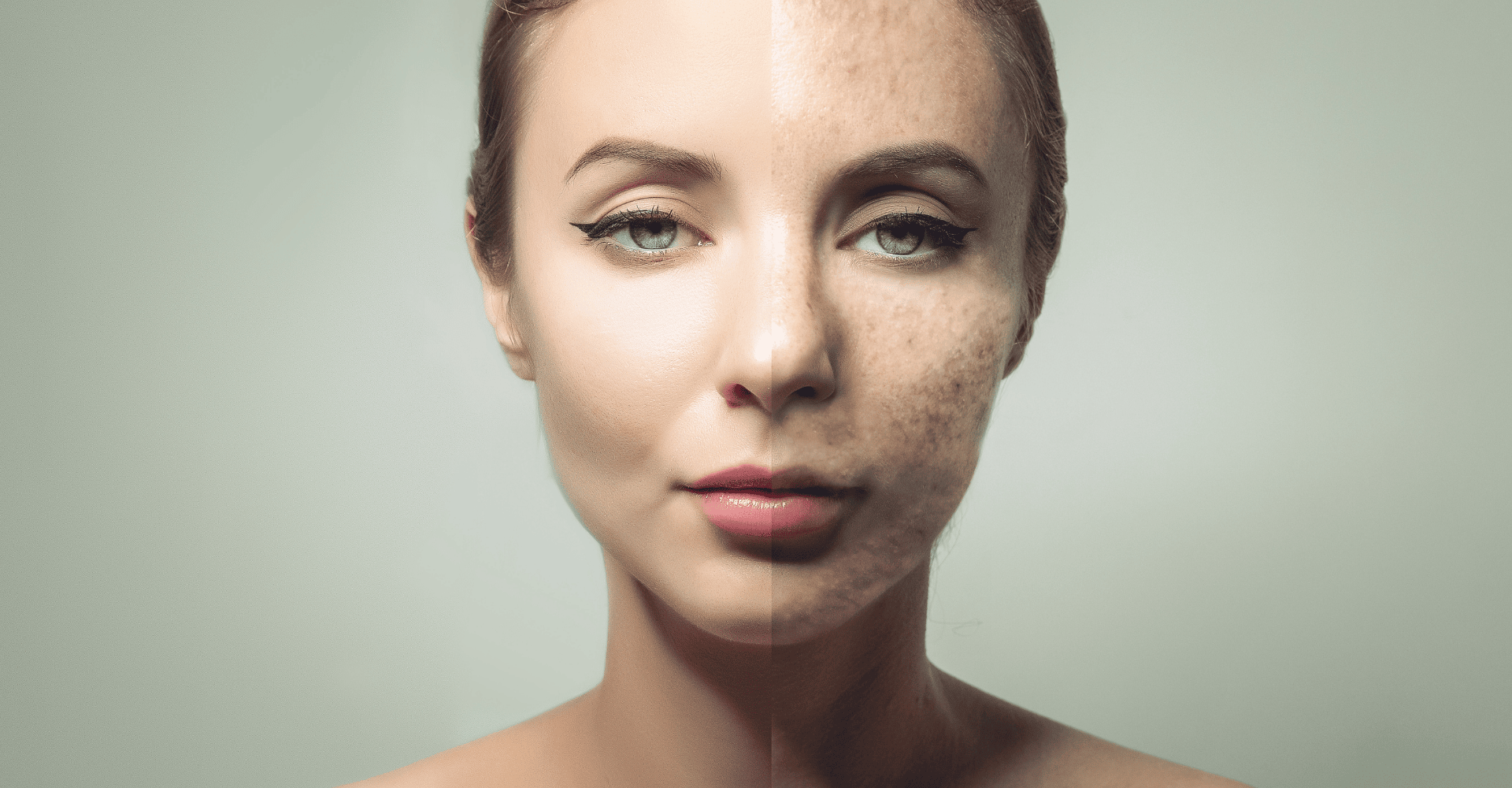 Skin Tag Removal with Liquid Nitrogen