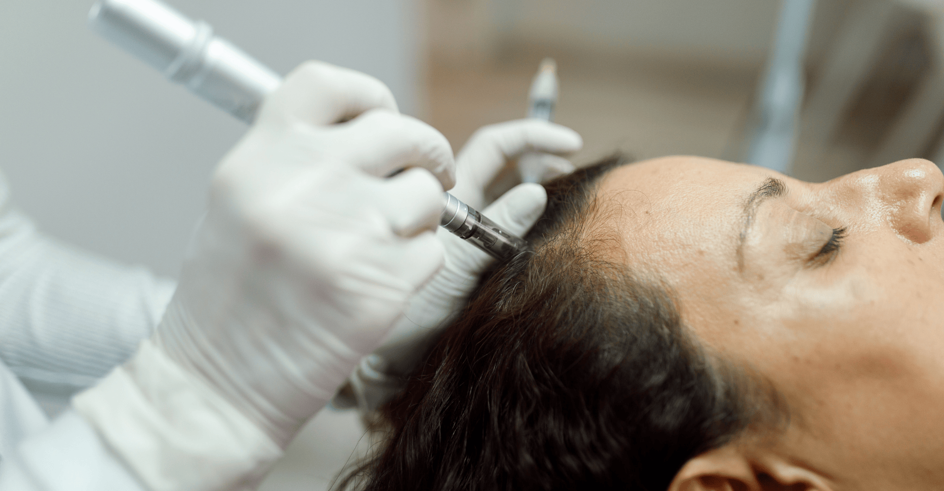 C-PRF Hair Restoration: A Natural Revolution in Hair Growth
