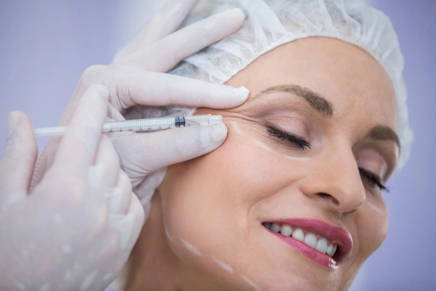 Botox — Natural Rejuvenation with Precision and Confidence