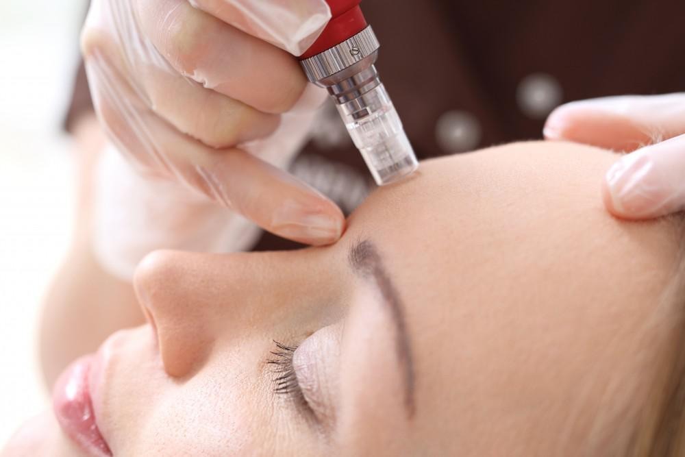Radiofrequency Microneedling with PRF + PDRN — The Ultimate Regenerative Skin Rejuvenation