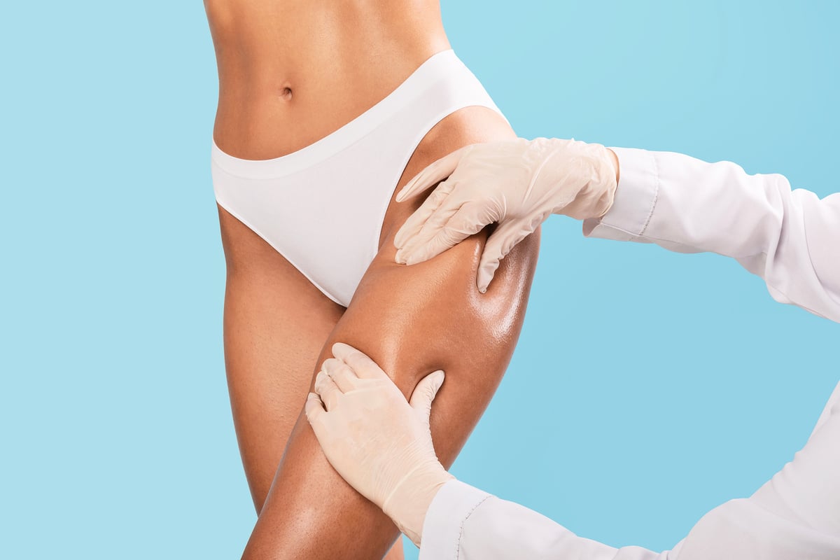 Thigh Liposuction