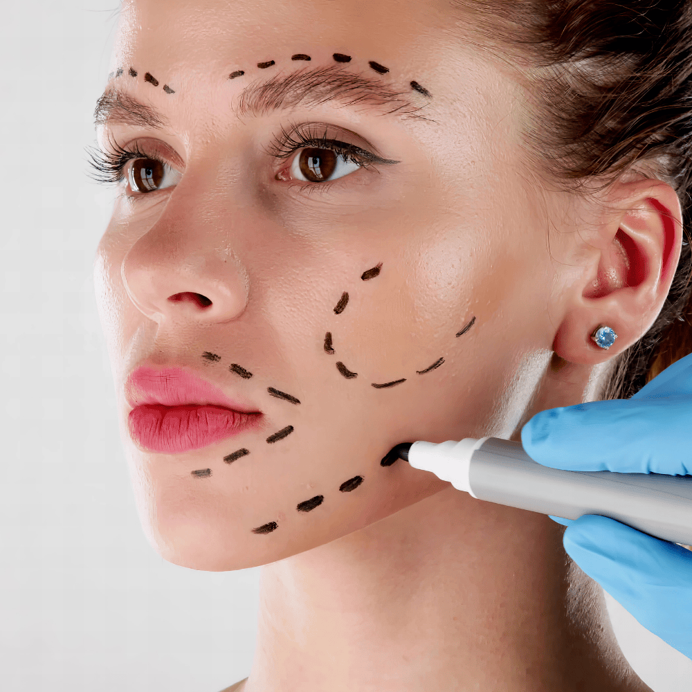 Vampire Facelift®: The Perfect Fusion of Fillers and PRF