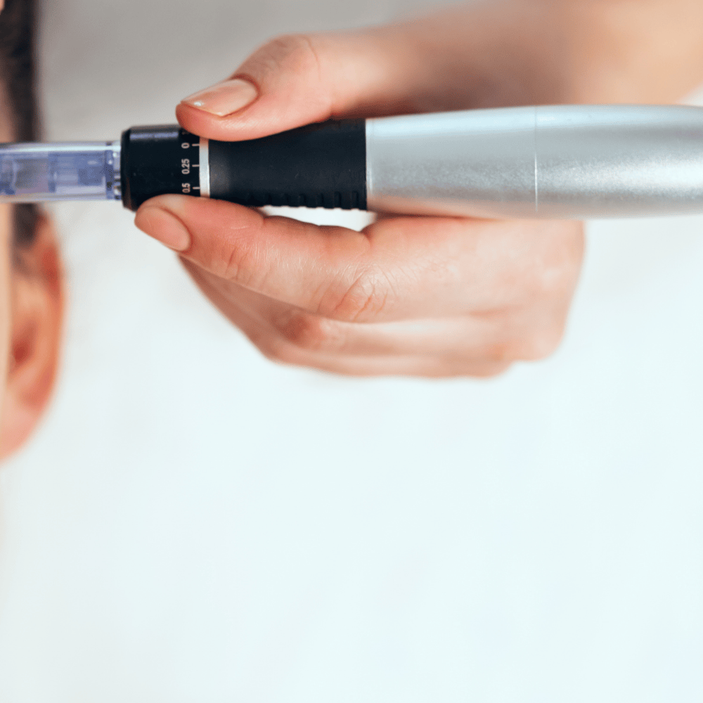icroneedling with Professional Dermapen Technology